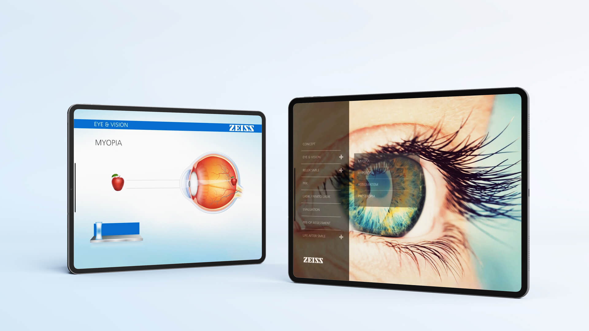 Ziess Android Application