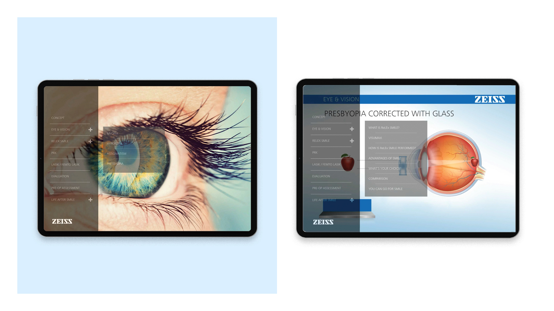 Zeiss - Android Application