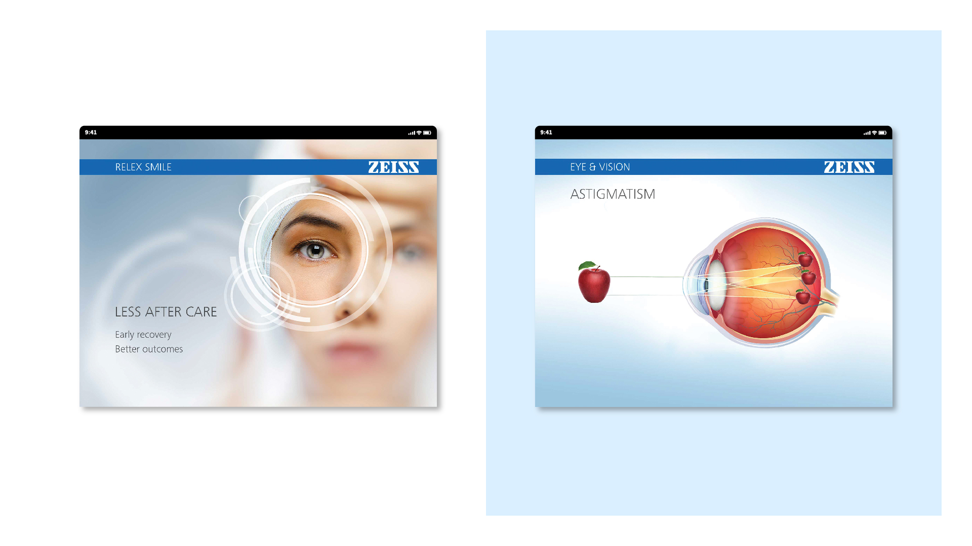 Zeiss - Android Application